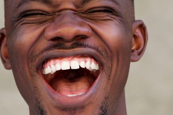 dry-mouth